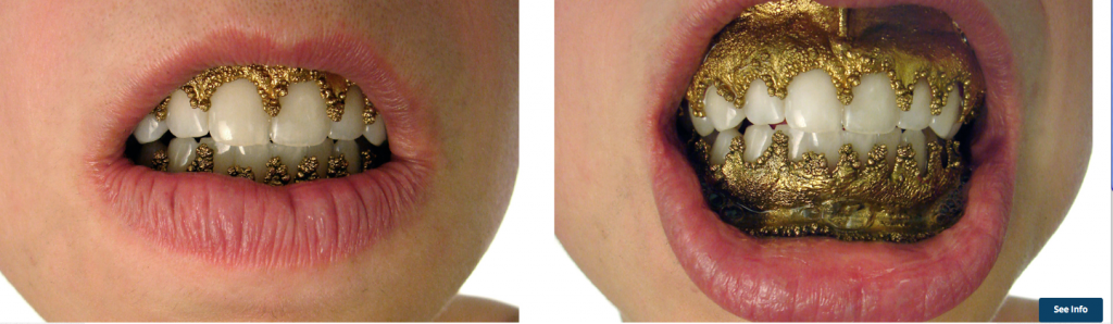 Image Credit: Lauren Kalman, Hard Wear (Oral Rims), 2006, inkjet print, Courtesy of Sienna Patti Contemporary
